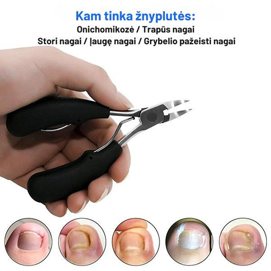 Žnyplutės odelių ir įaugusių nagų šalinimui