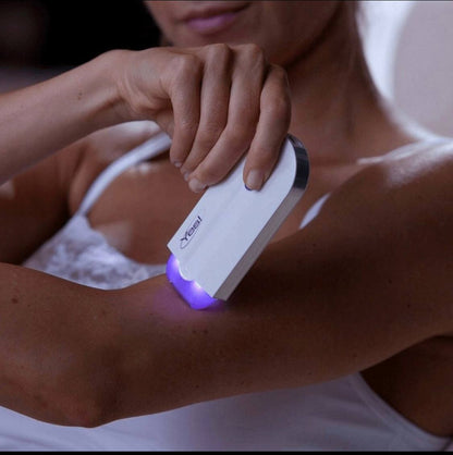 Plaukelių šalinimo prietaisas su LED šviesa – švelni ir lygi oda be skausmo