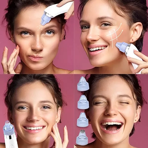 Porų valymo ir mikrodermabrazijos prietaisas „2-viename“ – švari ir švytinti oda be pastangų