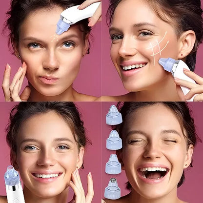 Porų valymo ir mikrodermabrazijos prietaisas „2-viename“ – švari ir švytinti oda be pastangų