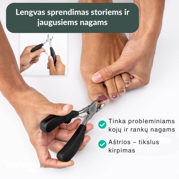 Žnyplutės odelių ir įaugusių nagų šalinimui