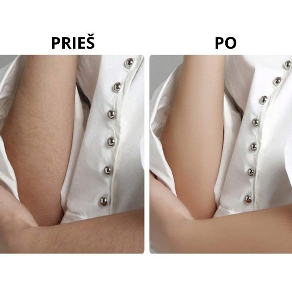 Plaukelių šalinimo prietaisas su LED šviesa – švelni ir lygi oda be skausmo