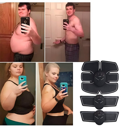 Elektrinis raumenų stimuliatorius kūno formavimui – degink riebalus ir stiprink raumenis be pastangų